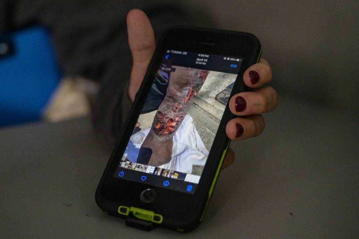 “Tranq”, la droga zombie que amenaza a Estados Unidos