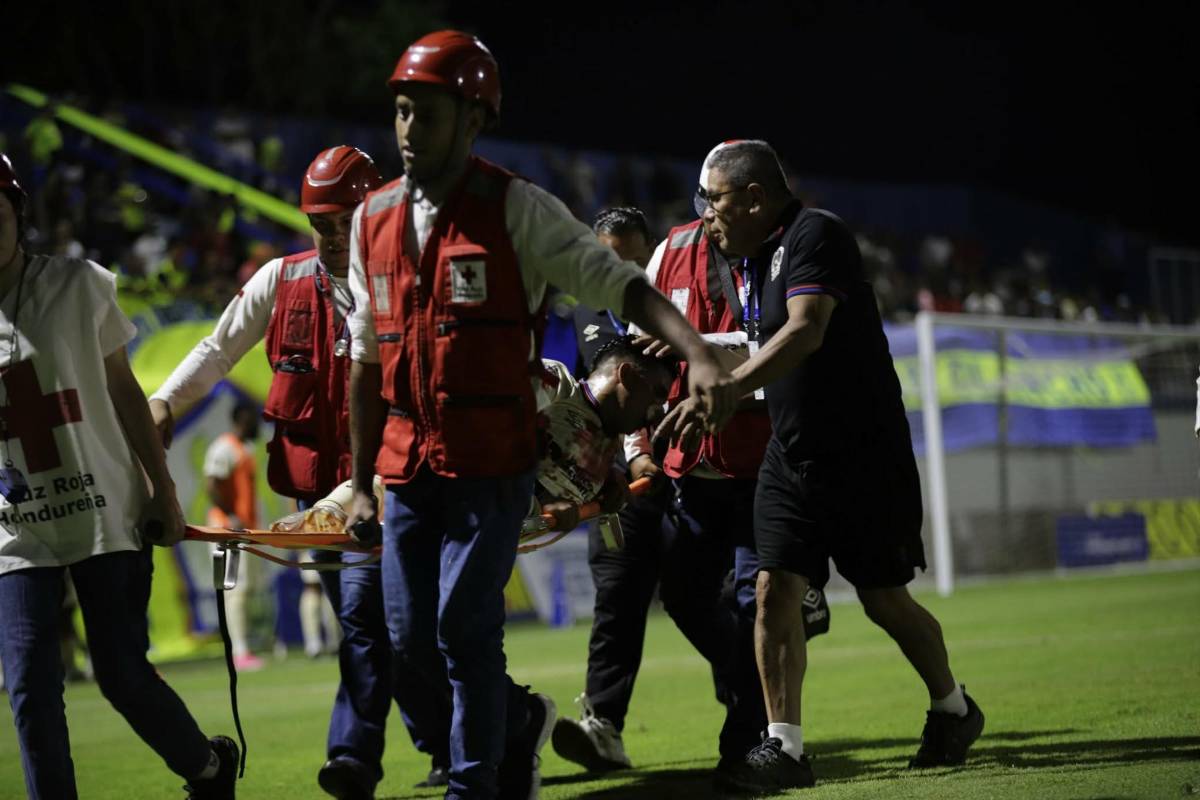 Milagro, bella colocha, fracturas en Olimpia y lo que pasó entre Benngtson y Espinel