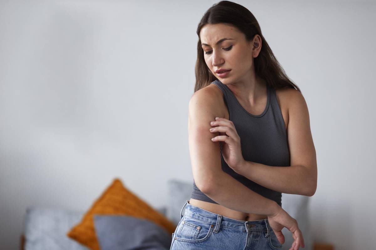 Cuídese de las picaduras de insectos en verano, pueden ser graves