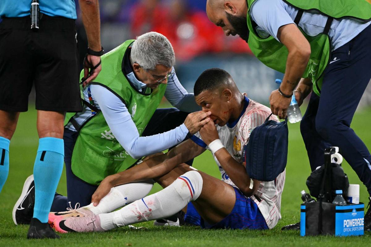 Mbappé recibió un durísmo golpe al intentar rematar de cabeza.