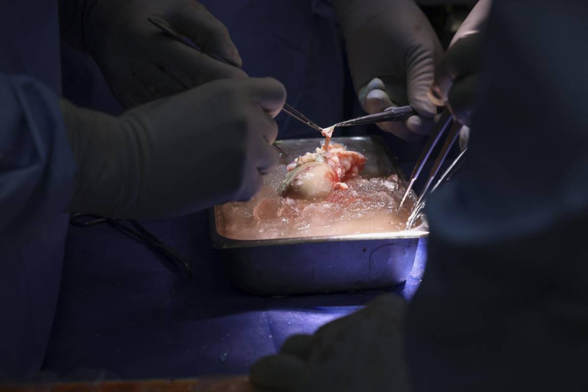 El hospital compartió imágenes del riñón que fue trasplantado.