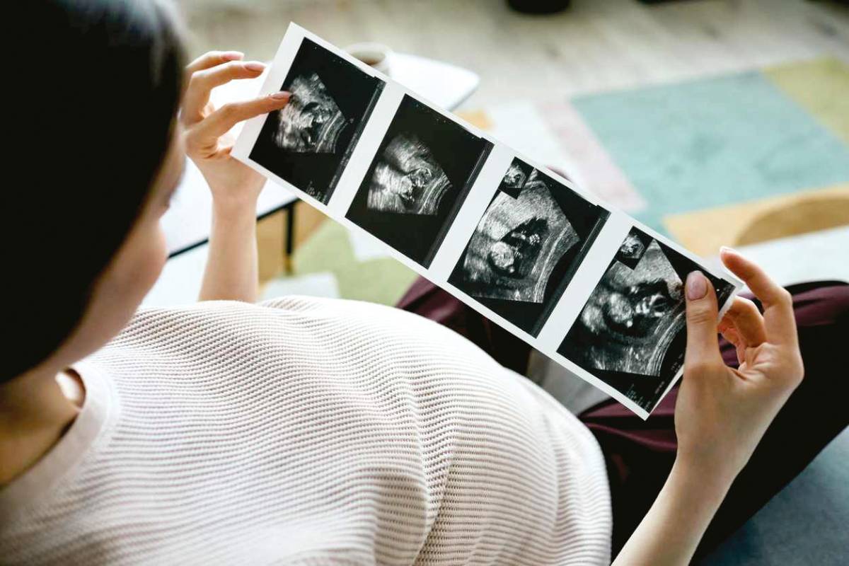 Cómo tener un embarazo conmente sana