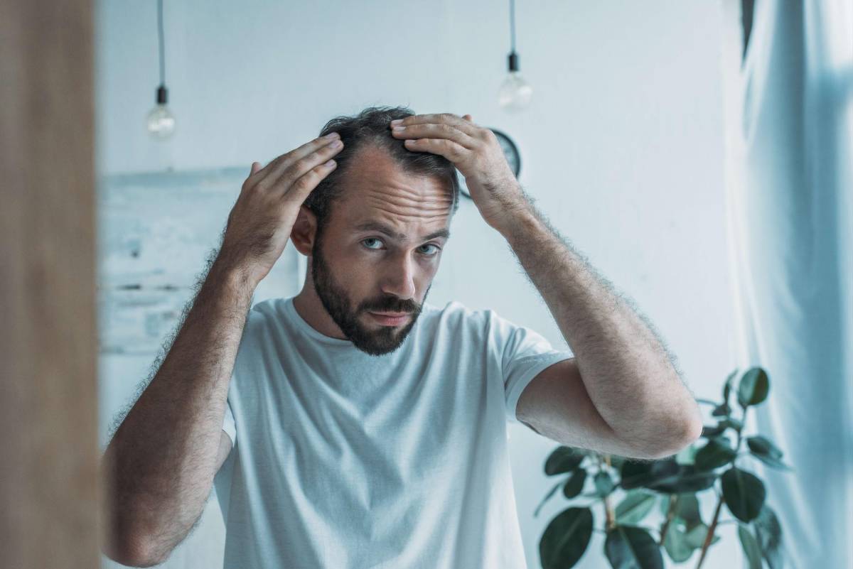 Tratamientos efectivos para combatir la alopecia