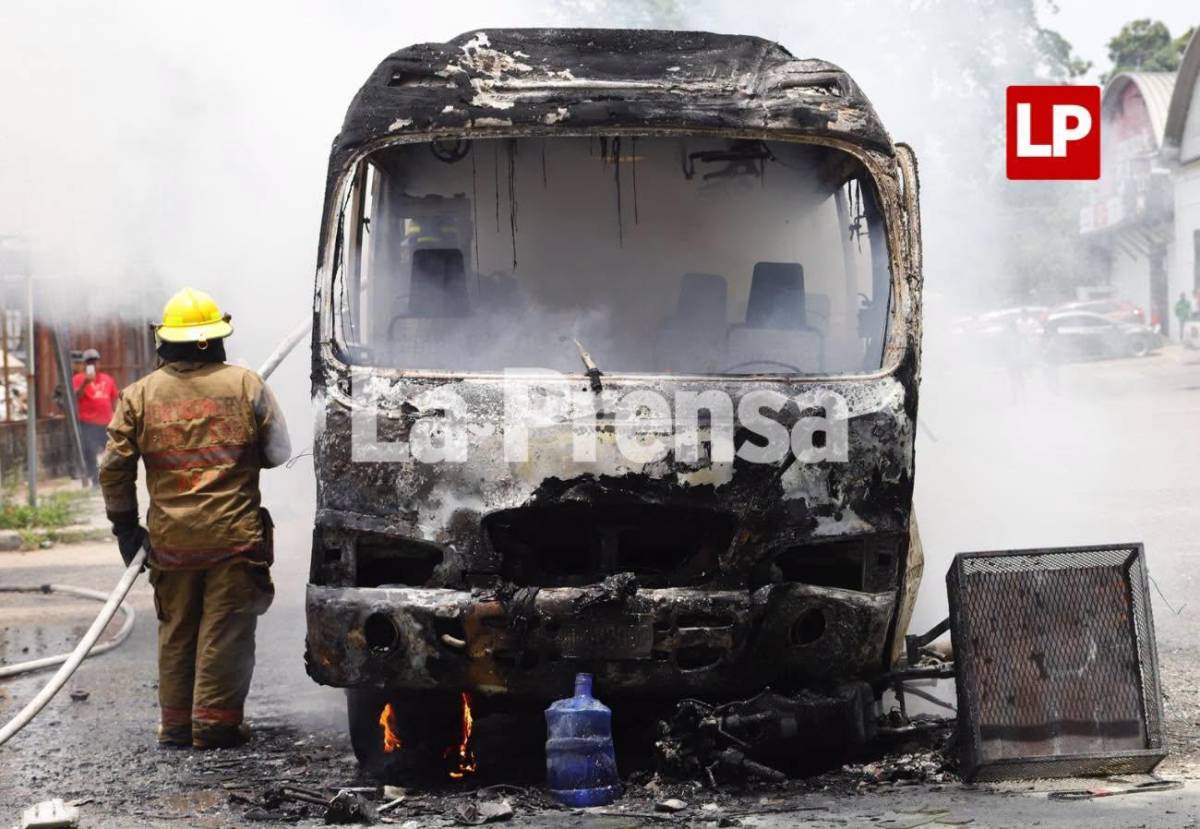 Conductor de moto que incendió bus en San Pedro Sula está en UCI con pronóstico reservado