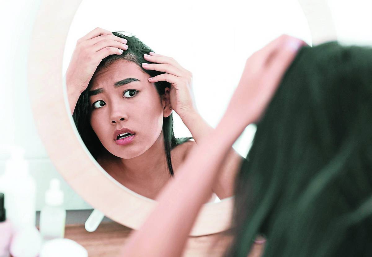 Pérdida de cabello: otra secuela del covid
