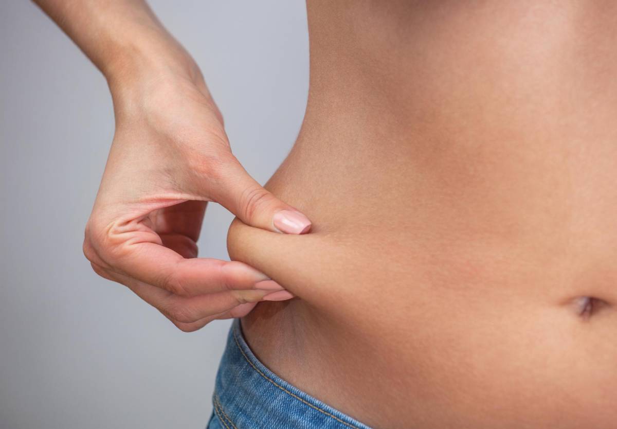 El exceso de grasa corporal se deja ver también en los “rollitos” que se forman en el abdomen.