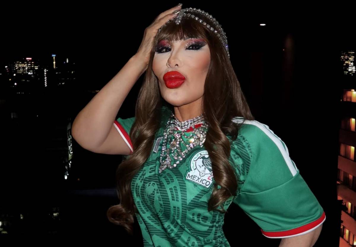 Triste testimonio: Lyn May revela por qué se deformó su rostro