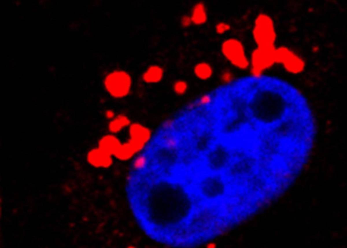 Científicos ensayan el primer anticuerpo que podría frenar la propagación del cáncer