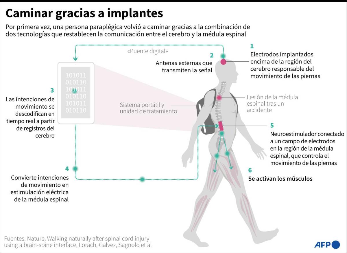 Un parapléjico vuelve a caminar gracias a la combinación de dos tecnologías