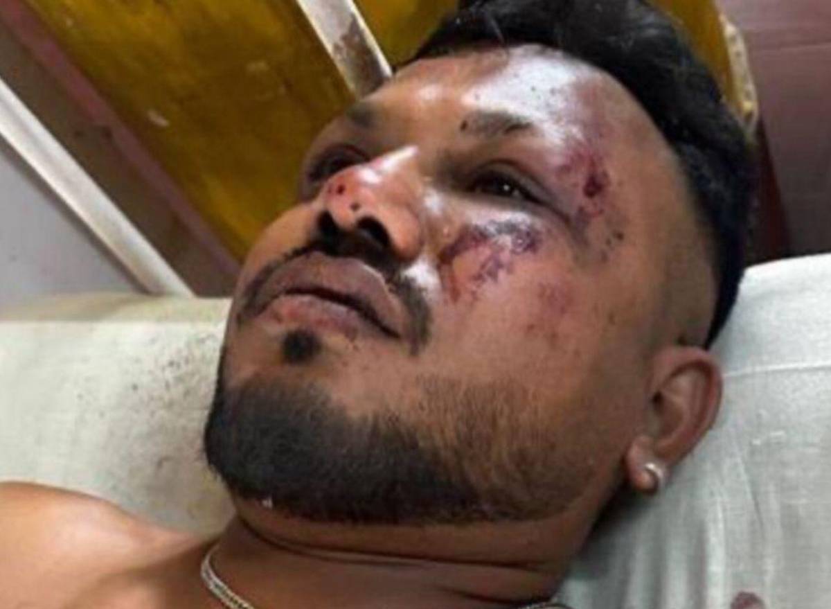 El rostro del milagro: Ramesh Vishwakumar, el único sobreviviente del accidente de Air India