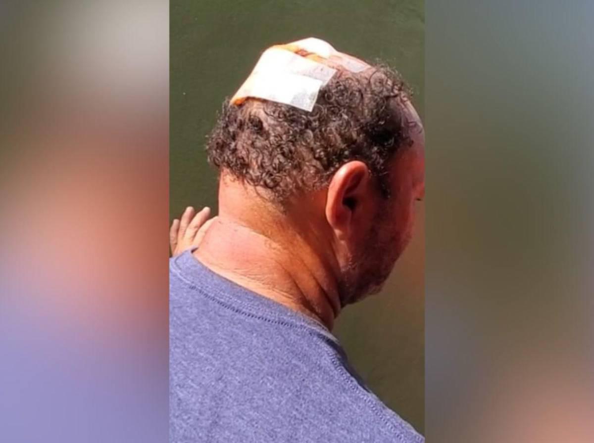 Es una injusticia que lo hayan dejado libre: Vigilante agredido en La Ceiba