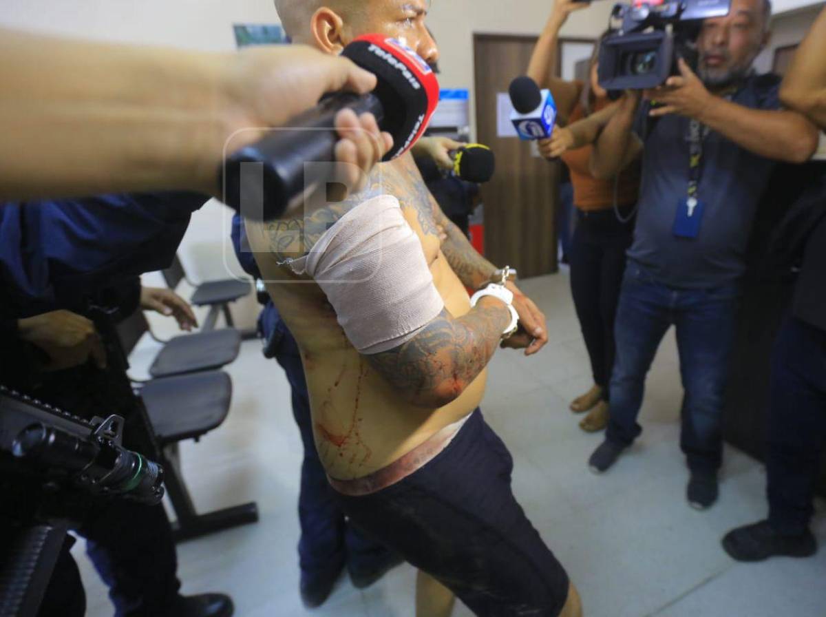 La Kleivona resultó herido durante operativo que terminó con su captura