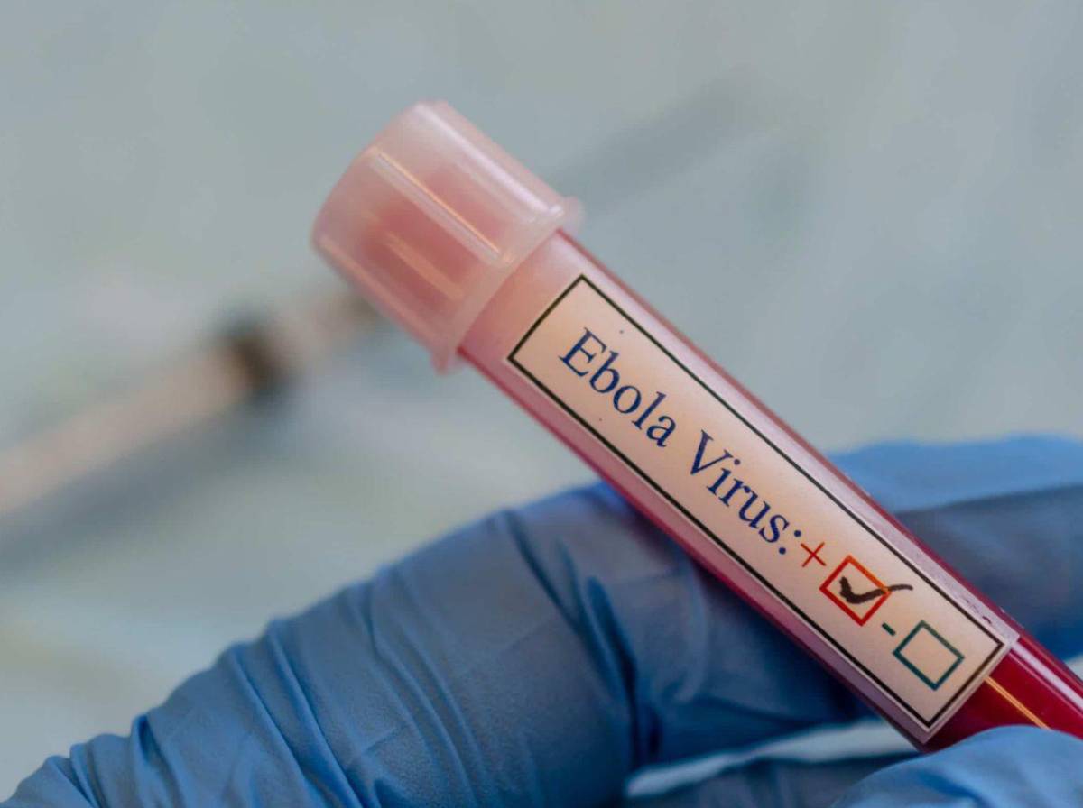 Van 88 muertos: brote letal de ébola obliga a la OMS a declarar emergencia internacional
