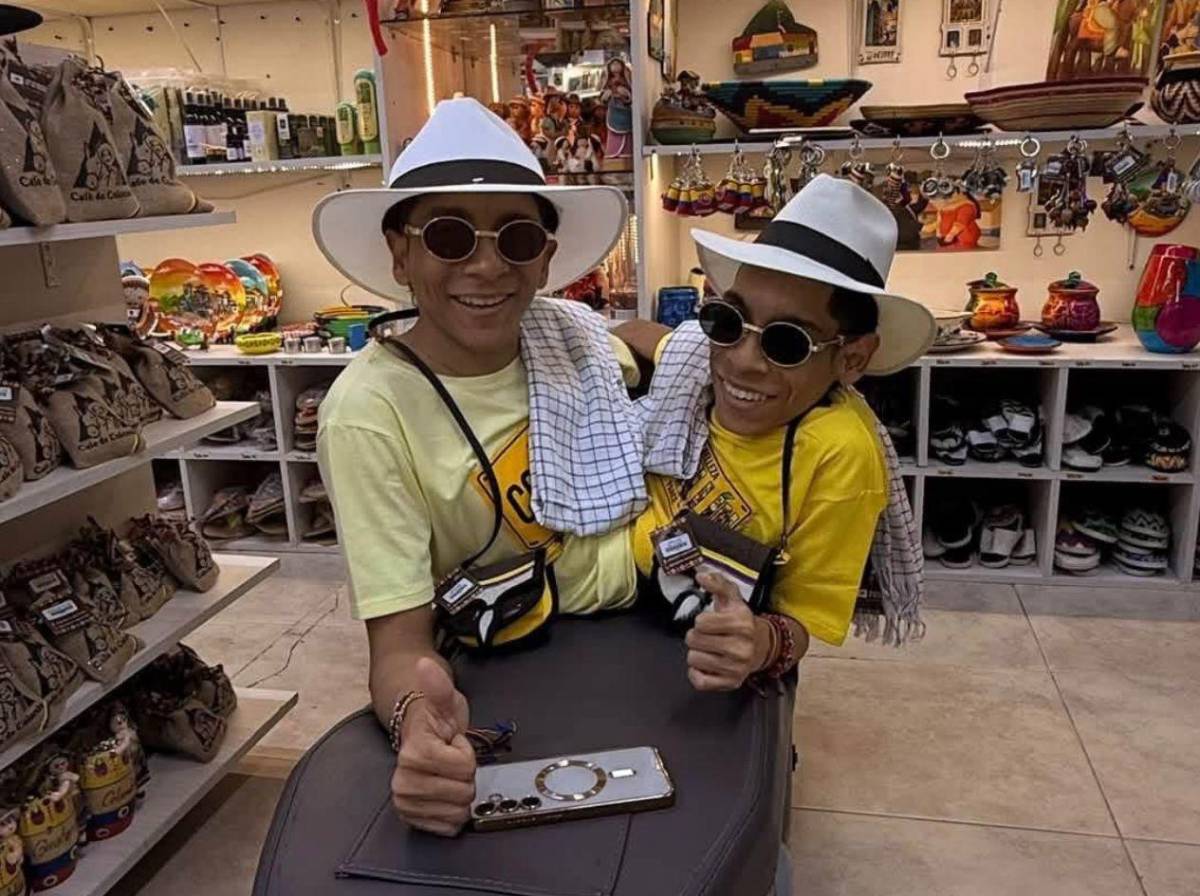 Mueren los hermanos siameses José Luis y José Armando Ceballos