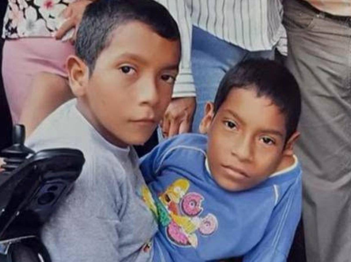 Mueren los hermanos siameses José Luis y José Armando Ceballos