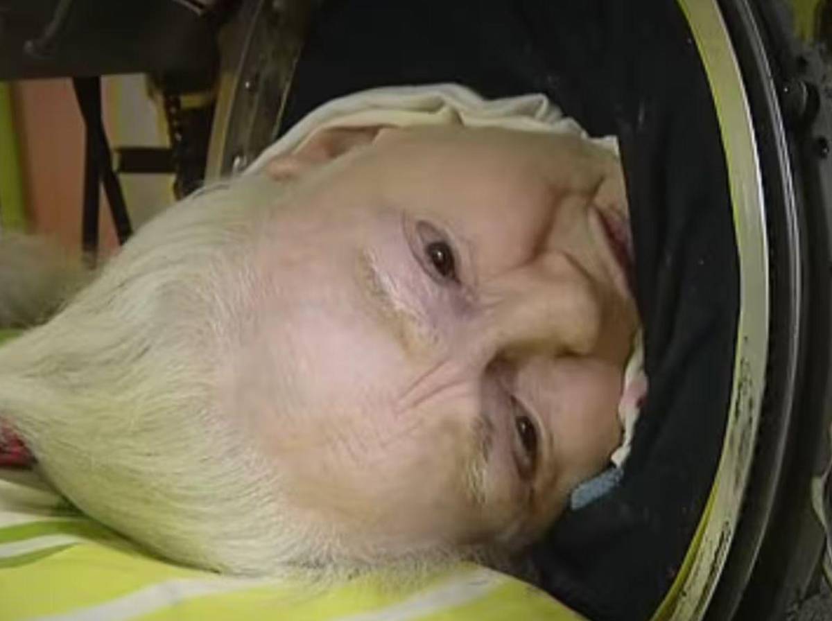 Muere Martha Lillard, la última paciente de polio en USA que usaba un pulmón de acero