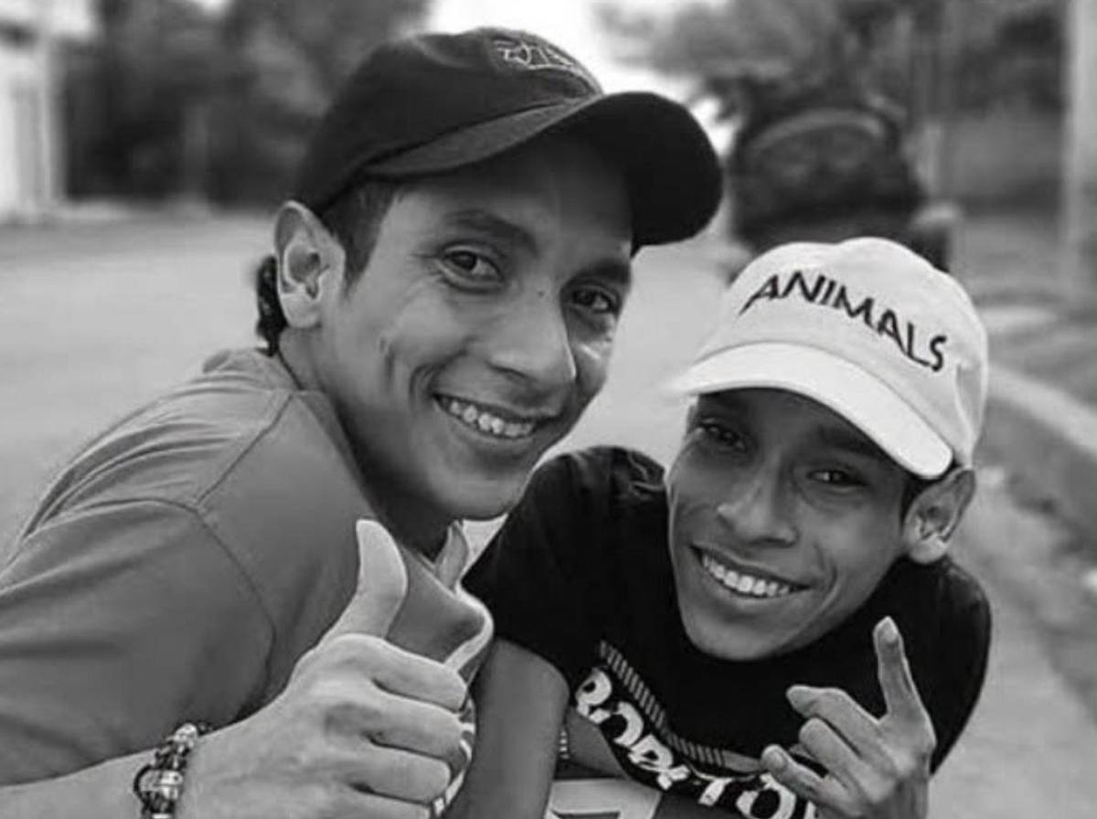 Mueren los hermanos siameses José Luis y José Armando Ceballos