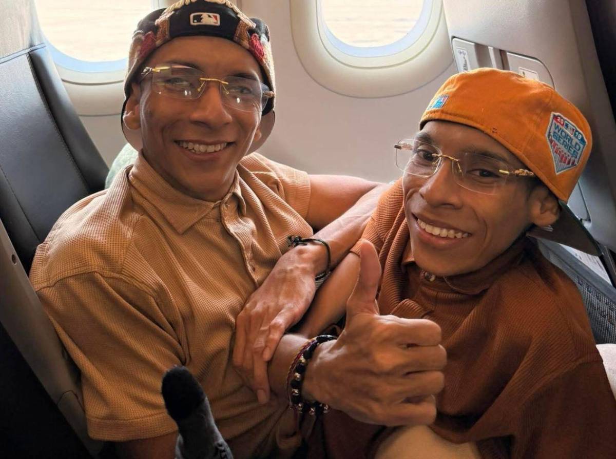 Mueren los hermanos siameses José Luis y José Armando Ceballos