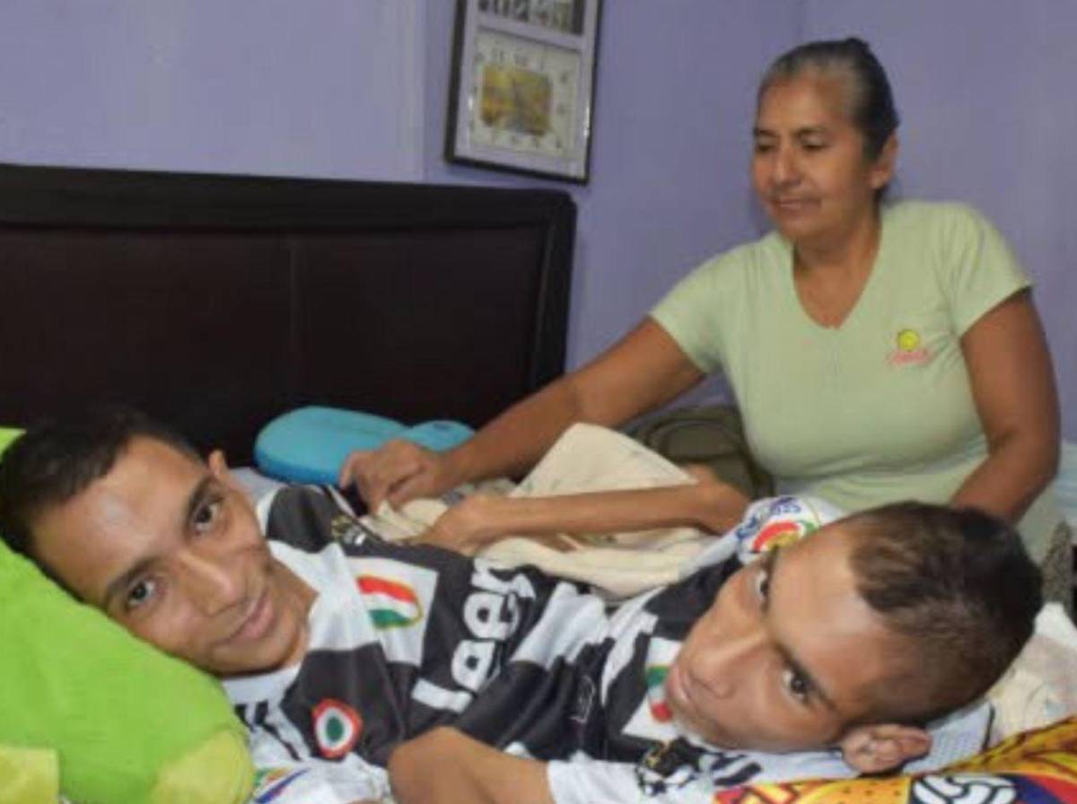 Mueren los hermanos siameses José Luis y José Armando Ceballos
