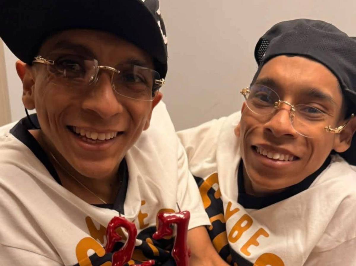 Mueren los hermanos siameses José Luis y José Armando Ceballos