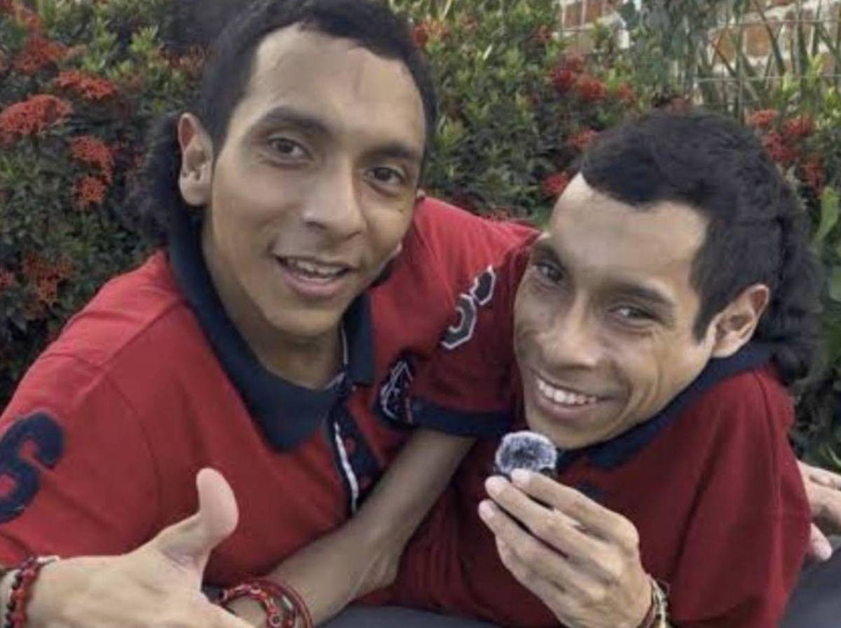 Mueren los hermanos siameses José Luis y José Armando Ceballos
