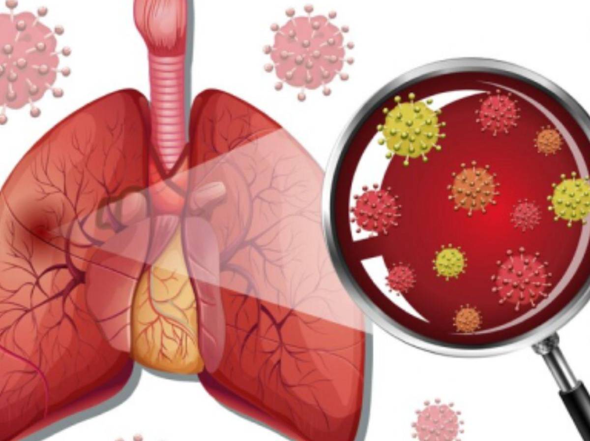 Alerta por hantavirus: qué es, cómo se transmite y cuáles son sus síntomas