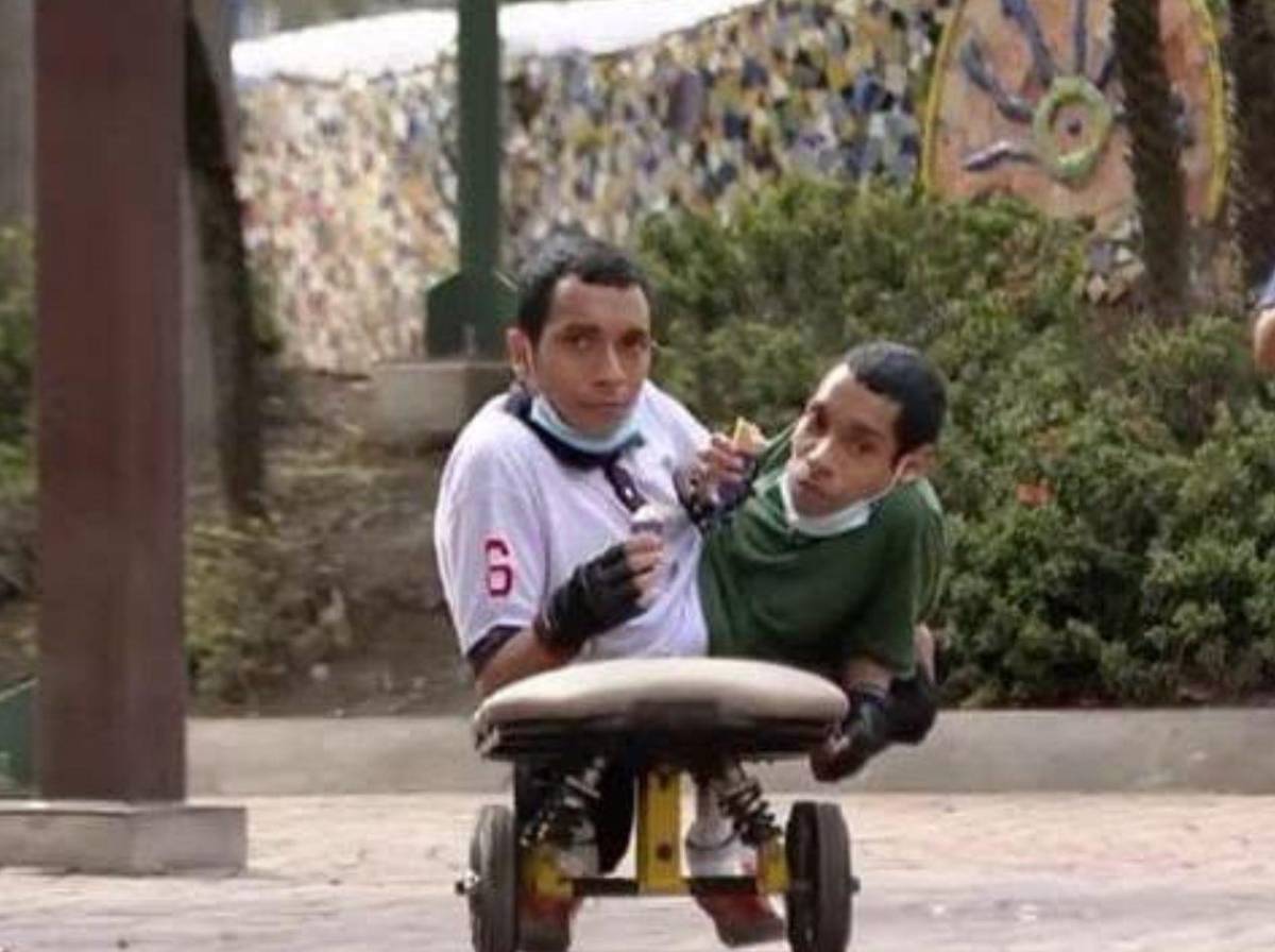 Mueren los hermanos siameses José Luis y José Armando Ceballos