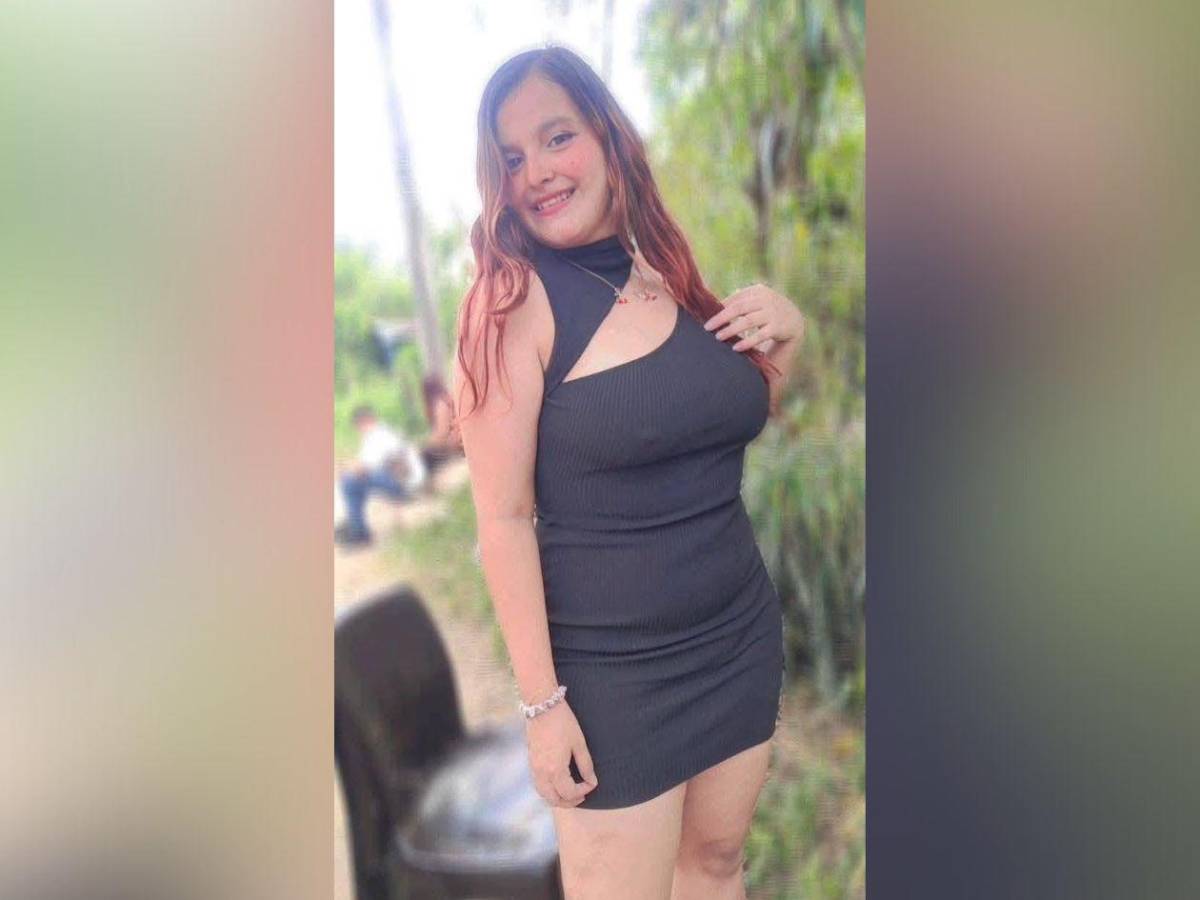 El error fatal que habría provocado accidente de bus en la colonia Lempira