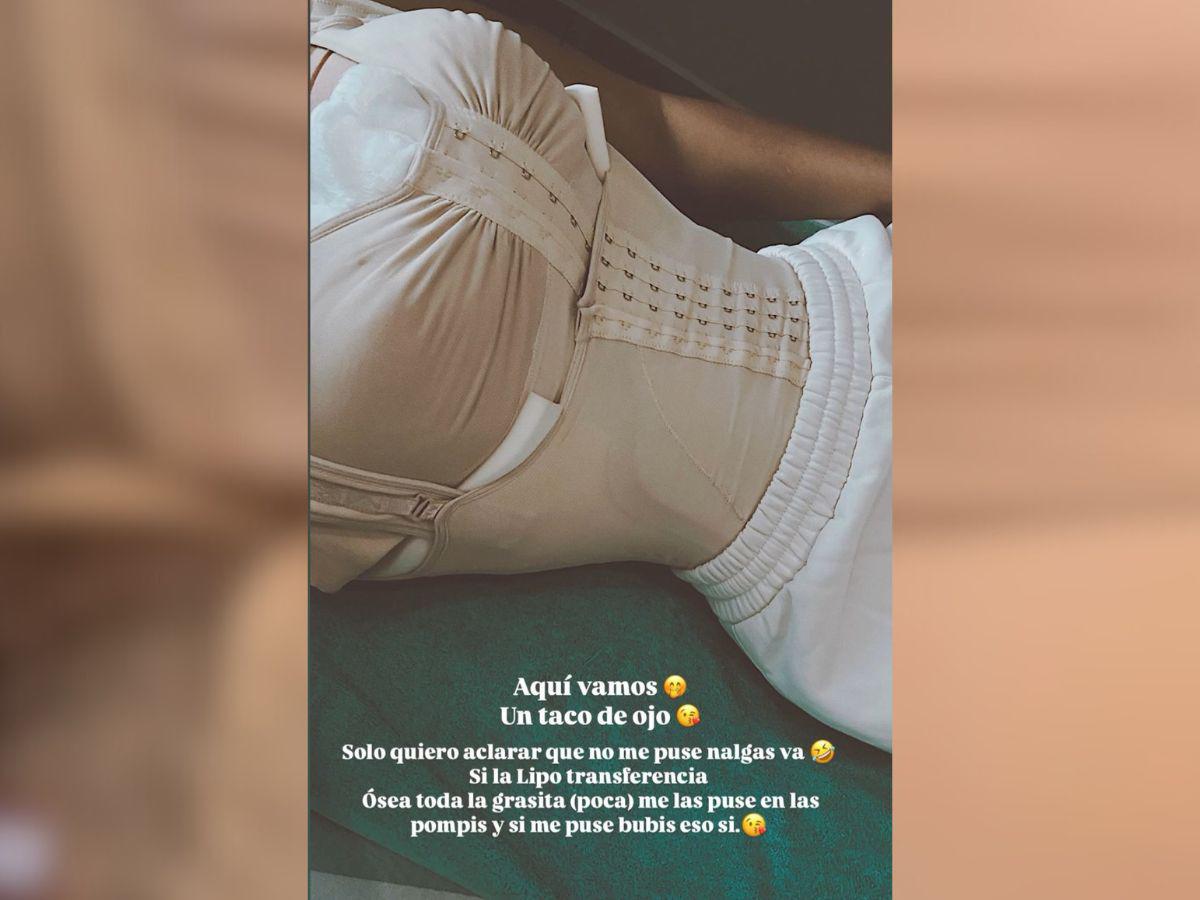 Kennia Mondragón presume su nuevo cuerpazo tras cirugía