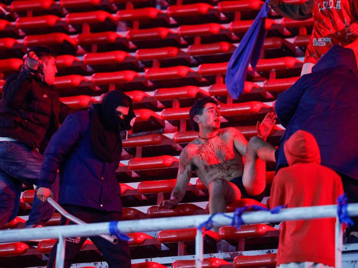 Imágenes sensibles: pelea de barras de Independiente y U de Chile deja heridos de gravedad