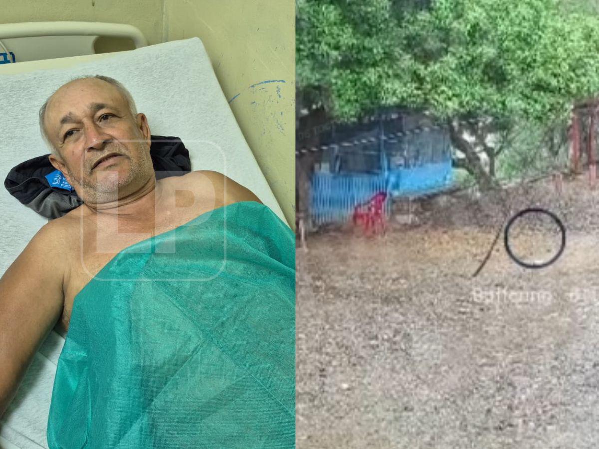 “Fue Dios el que me salvó”: don José Navas relata los momentos previos al impacto del rayo