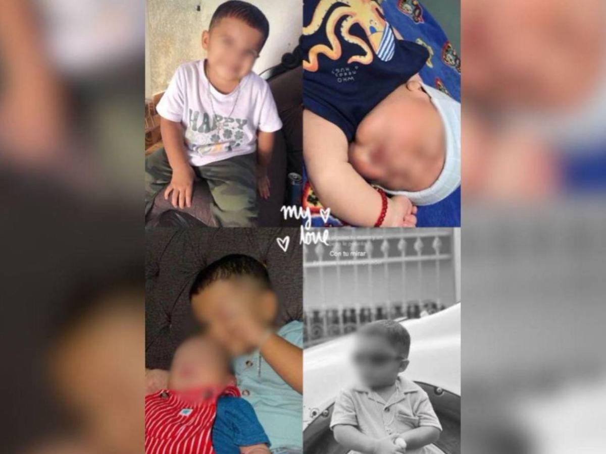 Amenazó con matar a mi mamá o mi papá: Dayani tras ser atacada a mordidas por su expareja