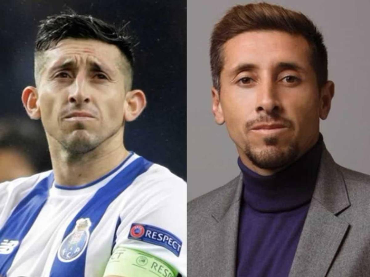 Se divorcia de uno de los ‘futbolistas más feos’ que se operó el rostro