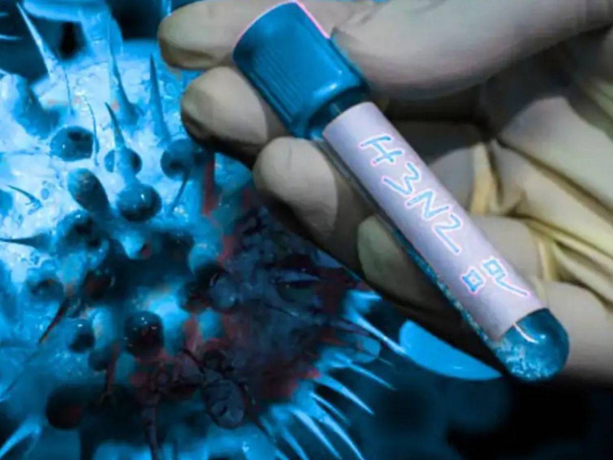 ¿Está preparado Honduras ante la posible llegada de la influenza A H3N2? Esto dicen la autoridades