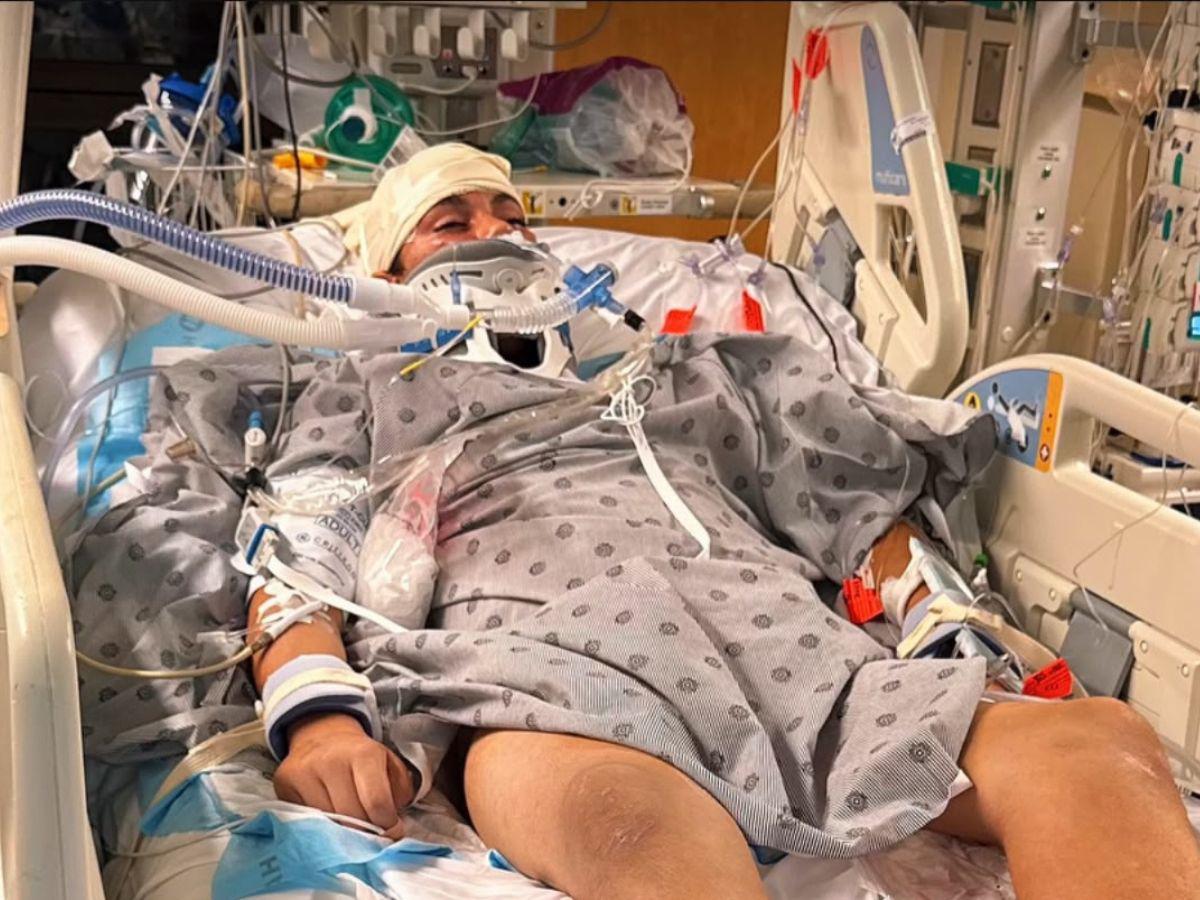 Niño hondureño muere asfixiado en un tobogán en parque de Miami