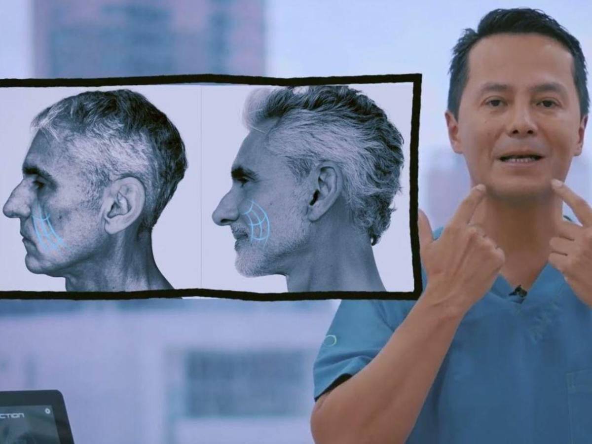 Antes y después del actor de Pedro el Escamoso, Miguel Varoni tras cirugía