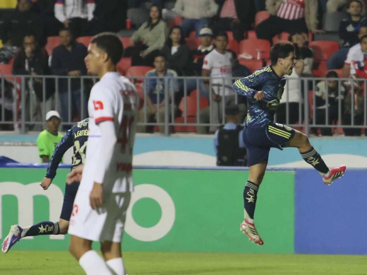 Olimpia se derrumba ante América, dedicatoria de Jorge Álvarez y novia de futbolista