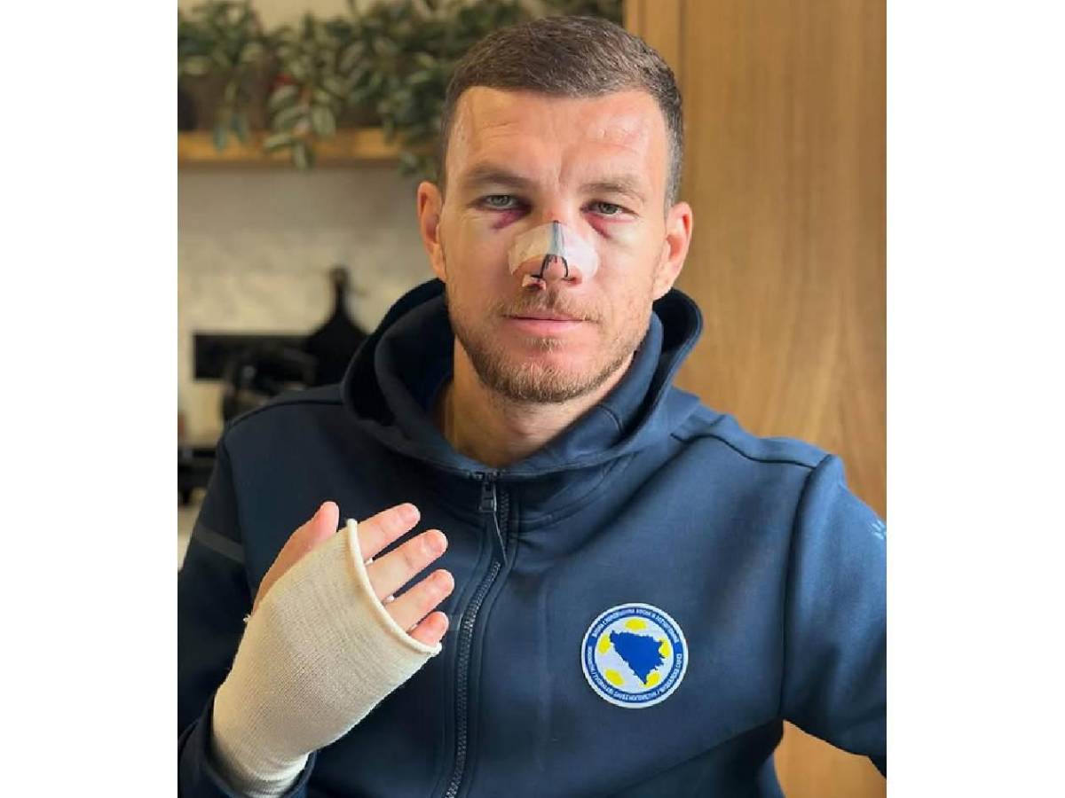 ¡Terrible! Sufrió brutal patada en partido y revela cómo le quedó el rostro