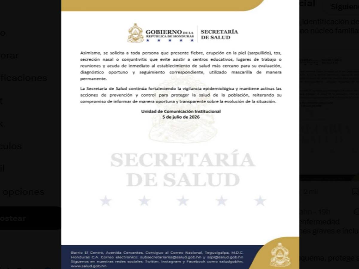 Cuatro miembros de una familia en San Pedro Sula dan positivo a sarampión