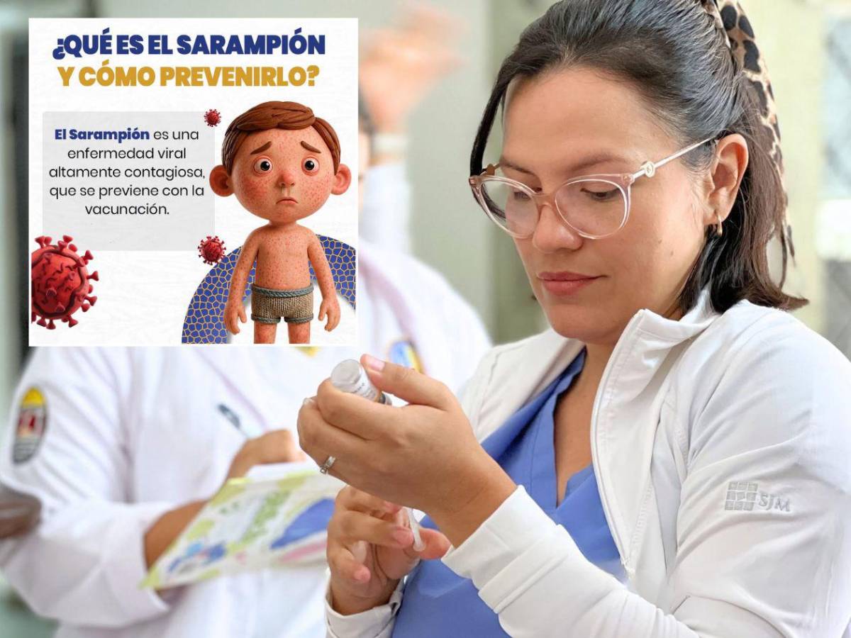 Cinco señales de alerta ante brote de sarampión en el sector Cofradía