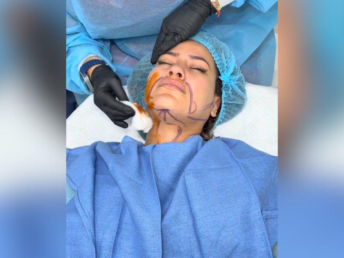 Alejandra Rubio revela el precio de su costosa cirugía