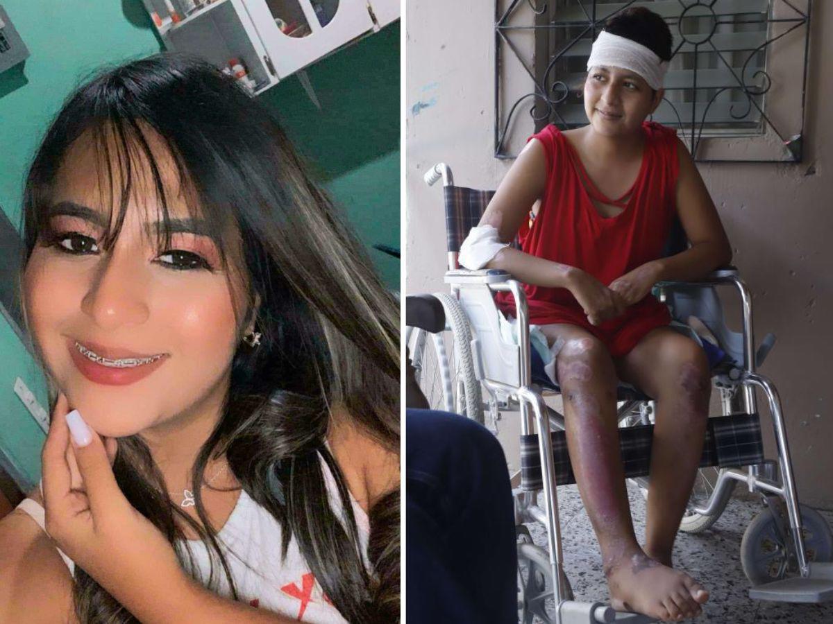 “Los médicos dicen que sobreviví de milagro, pido justicia”: Hazel Michell