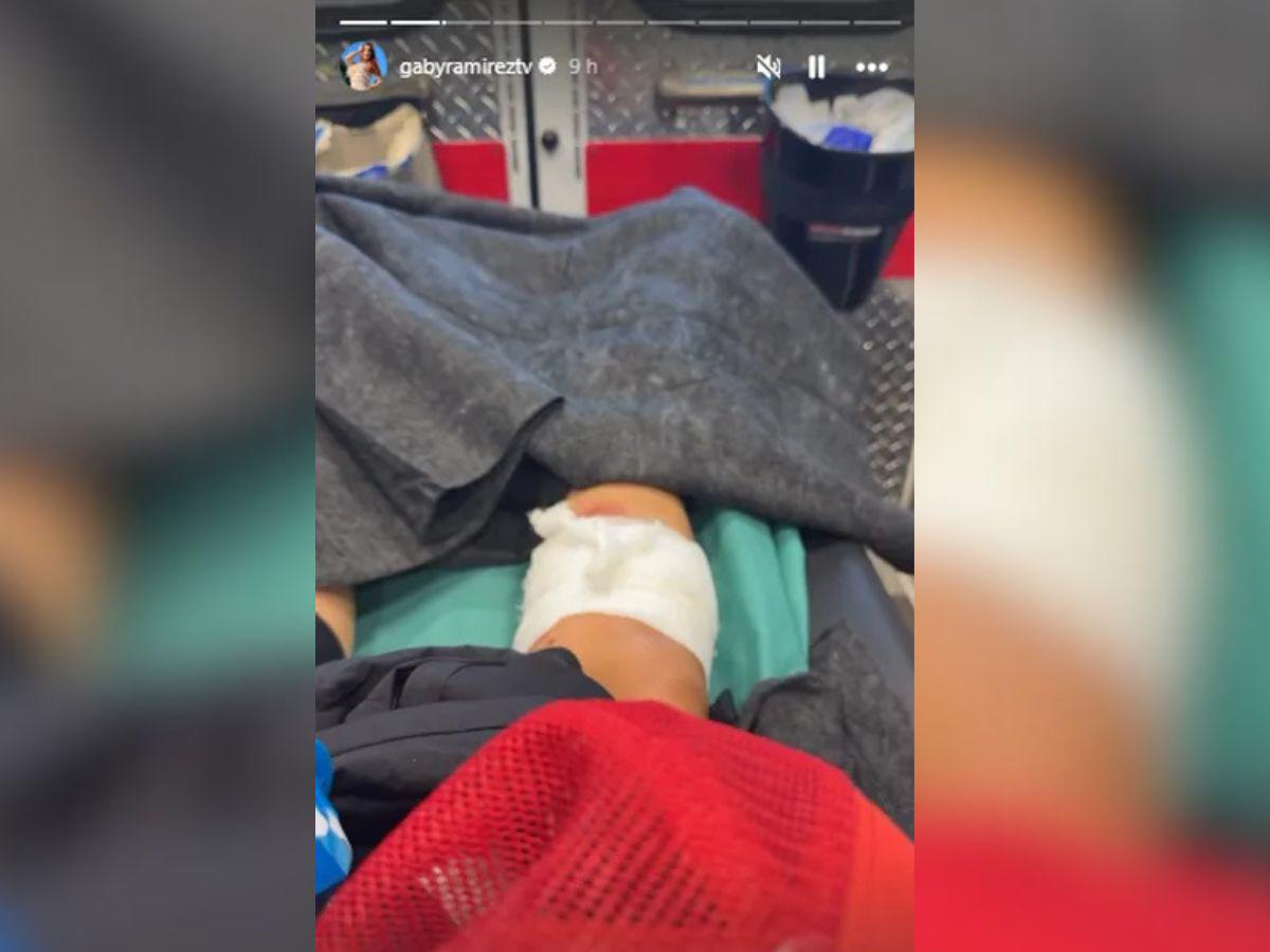 Querida actriz de Televisa sufre ataque de un pitbull: Puedo perder una extremidad