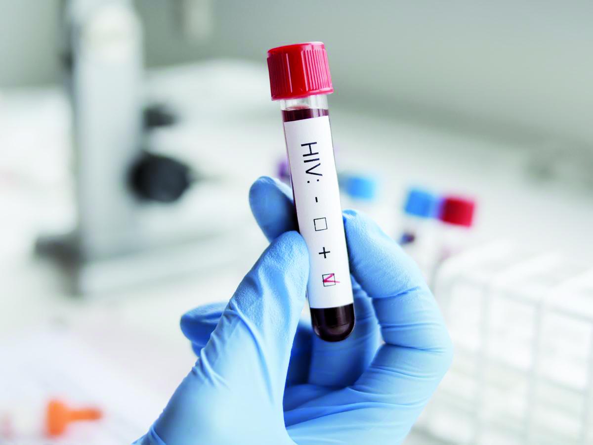 Capital Industrial suma el mayor número de casos de VIH en últimos 39 años