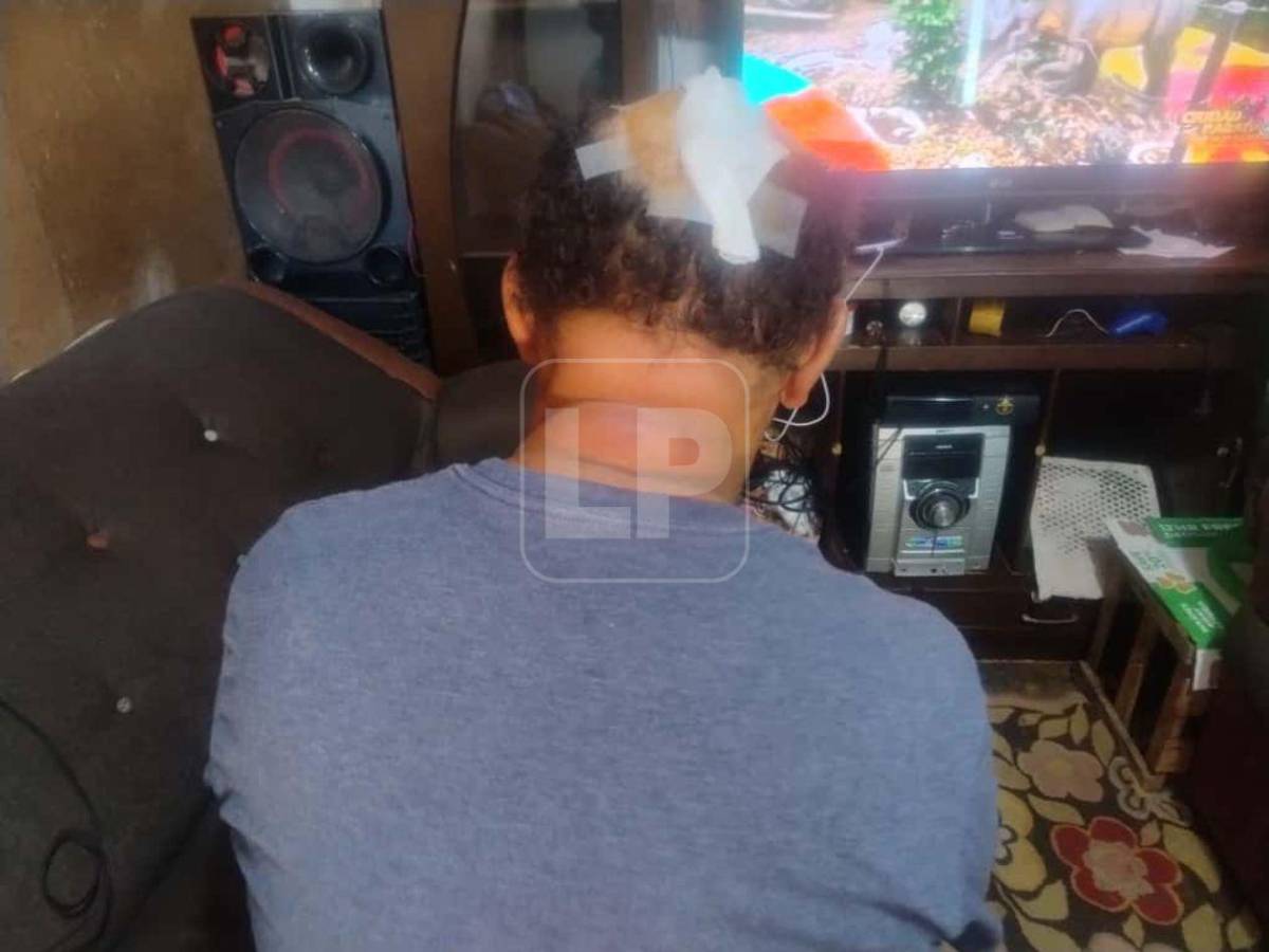 Es una injusticia que lo hayan dejado libre: Vigilante agredido en La Ceiba