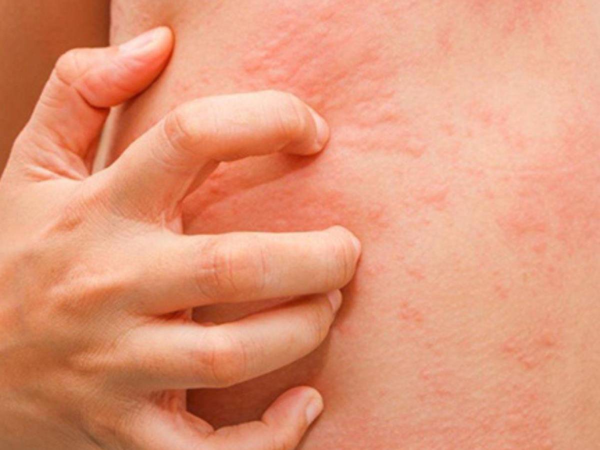 Muere abogada tras someterse a una tomografía computarizada