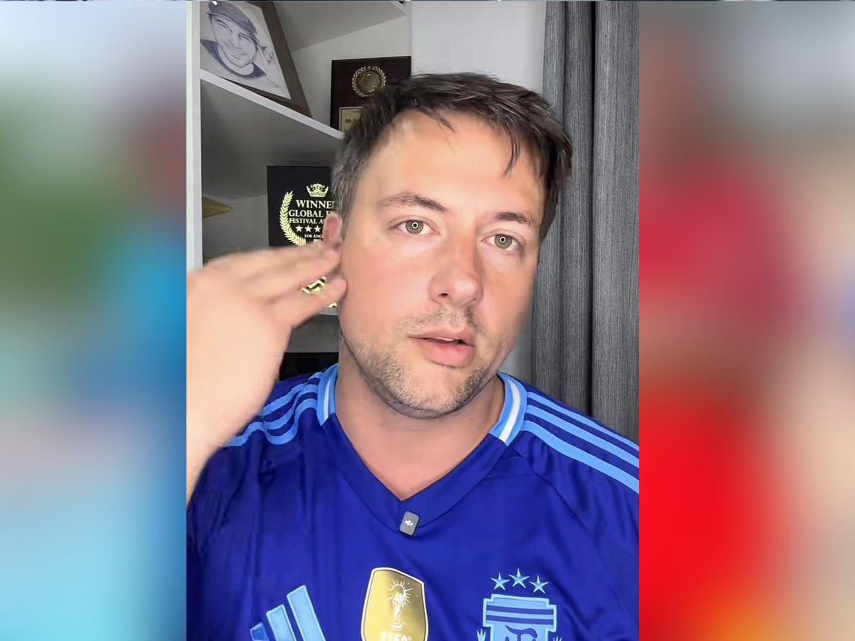 Gustavo Leone sufre parálisis facial después de comprometerse con Karlen Pérez