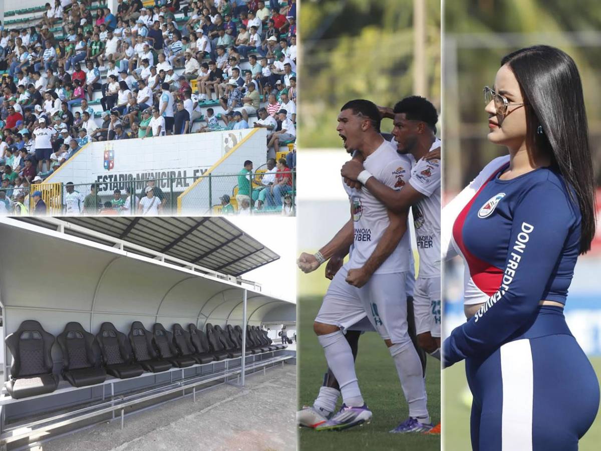 Amargo regreso de Platense al Excélsior, modelo cautiva y el insólito error de Saíd Martínez