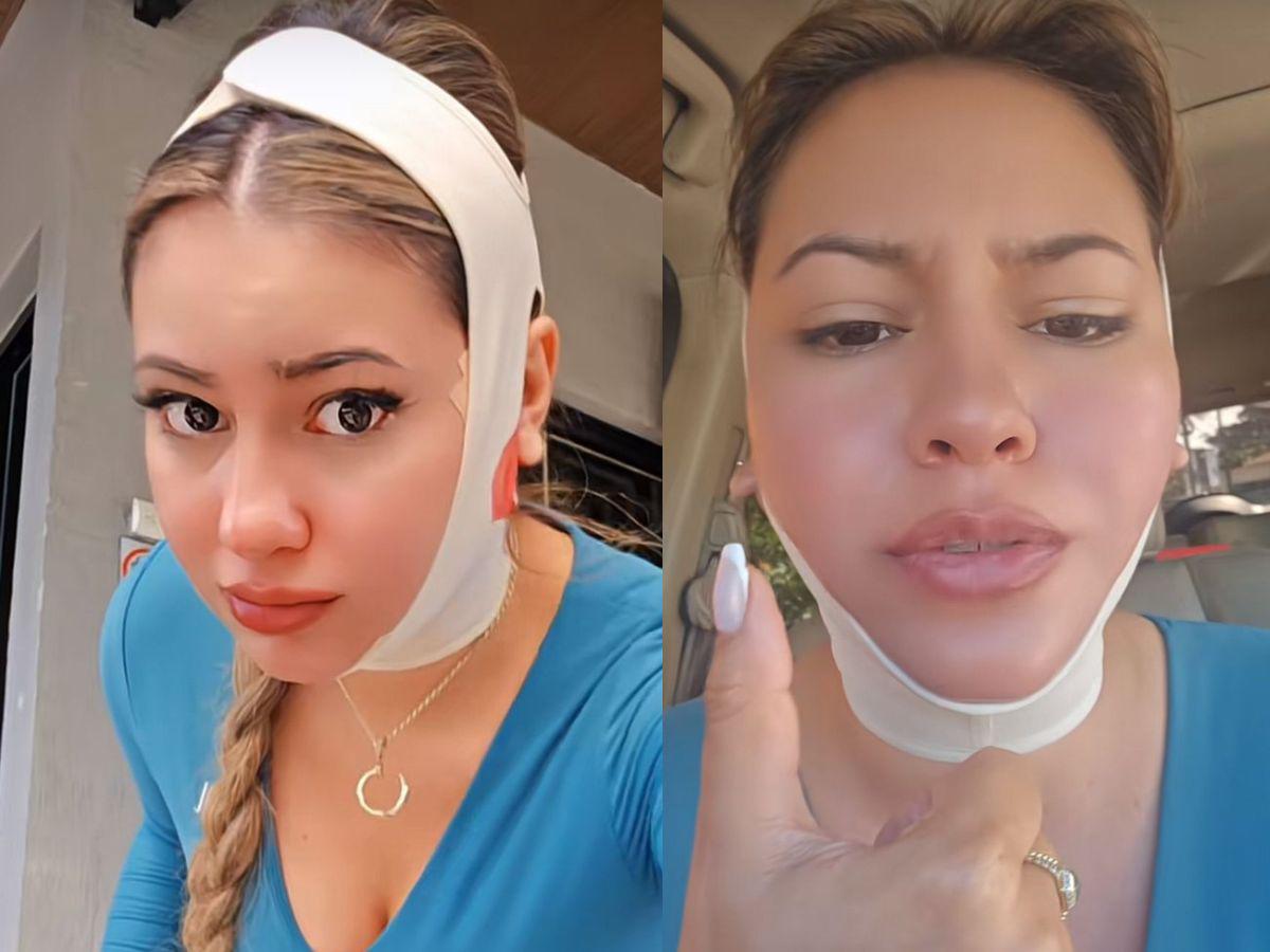 Alejandra Rubio revela el precio de su costosa cirugía