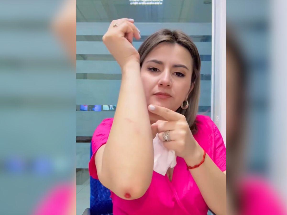 Cesia Mejía aparece con golpes en su cuerpo y preocupa a sus seguidores